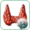 enucleoresezione tiroidea